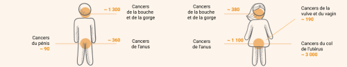 Infographie cancer du papillomavrius